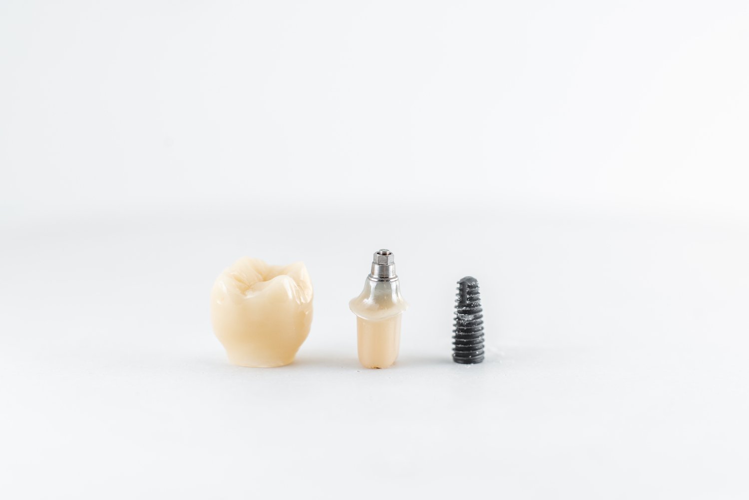 Dental crown and implant model at The Port Dental Clinic