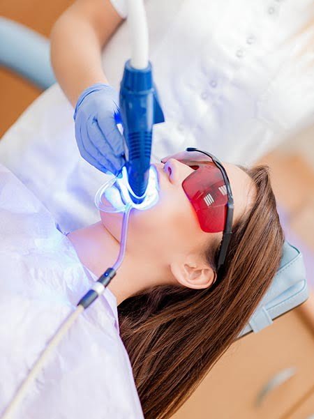 The Truth About Teeth Whitening: What Works and What Doesn't