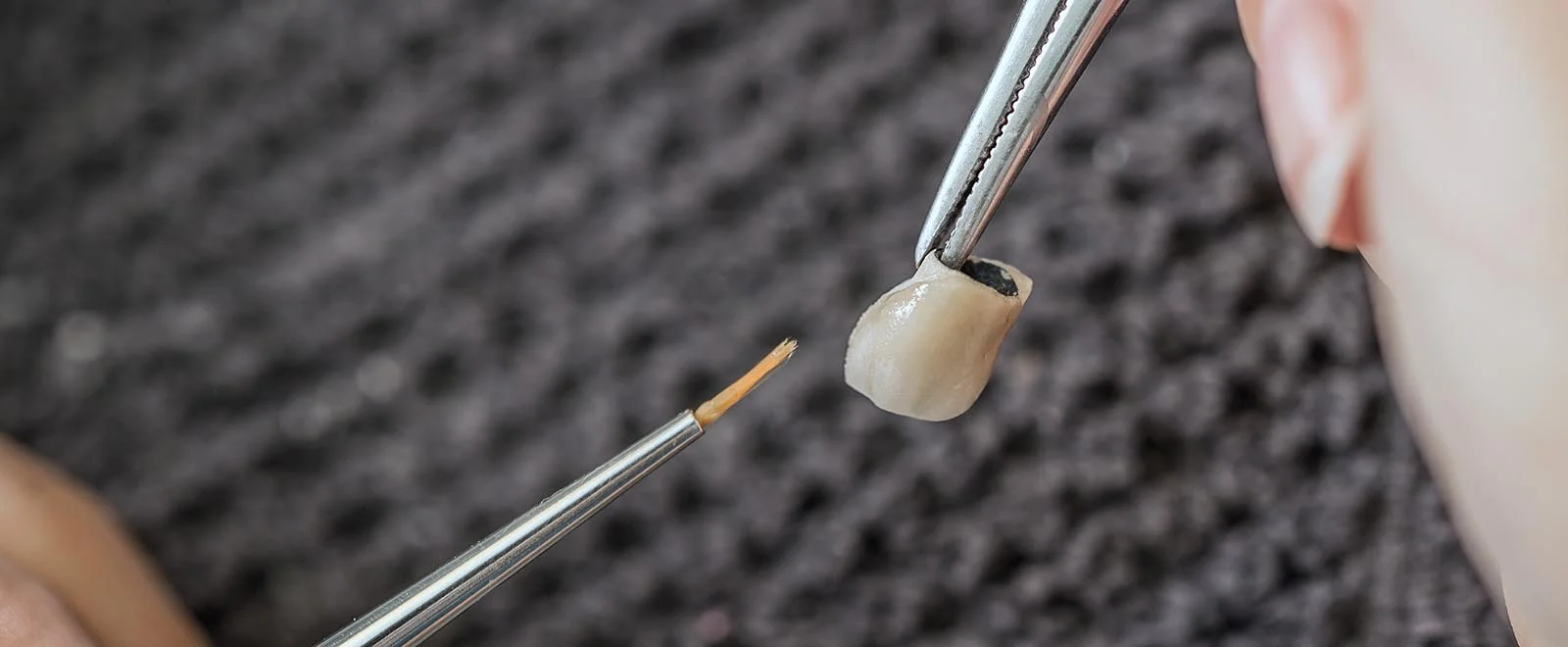 Dental crown placement at The Port Dental Clinic