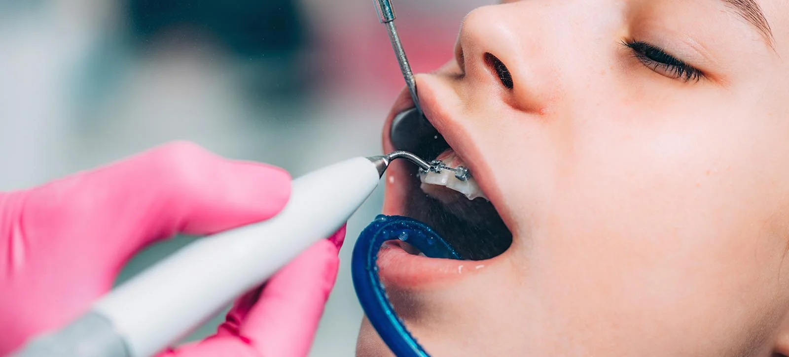 Comprehensive dental exam and checkup with digital X-rays at The Port Dental Clinic Calgary NE