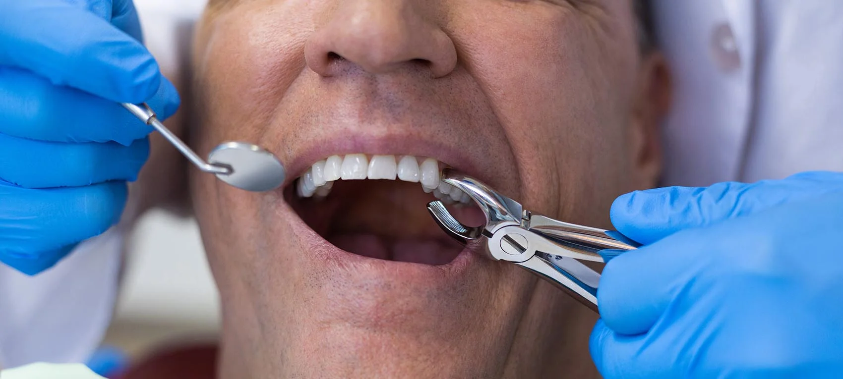 Tooth extraction procedure at The Port Dental Clinic