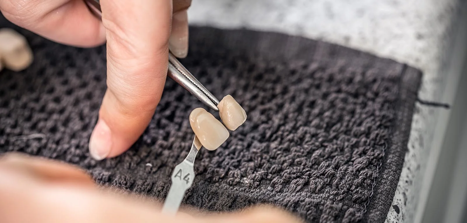 Porcelain veneers smile transformation at The Port Dental Clinic